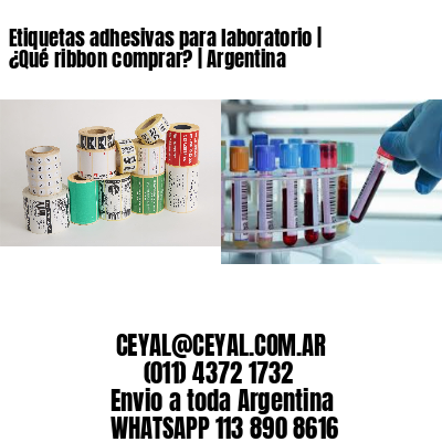 Etiquetas adhesivas para laboratorio | ¿Qué ribbon comprar? | Argentina